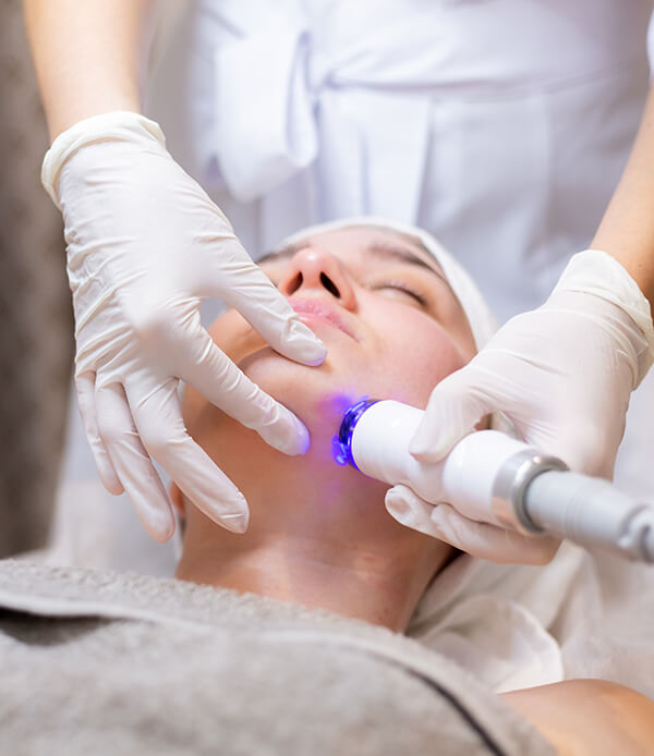 radiofrekwencja mikroiglowa RF