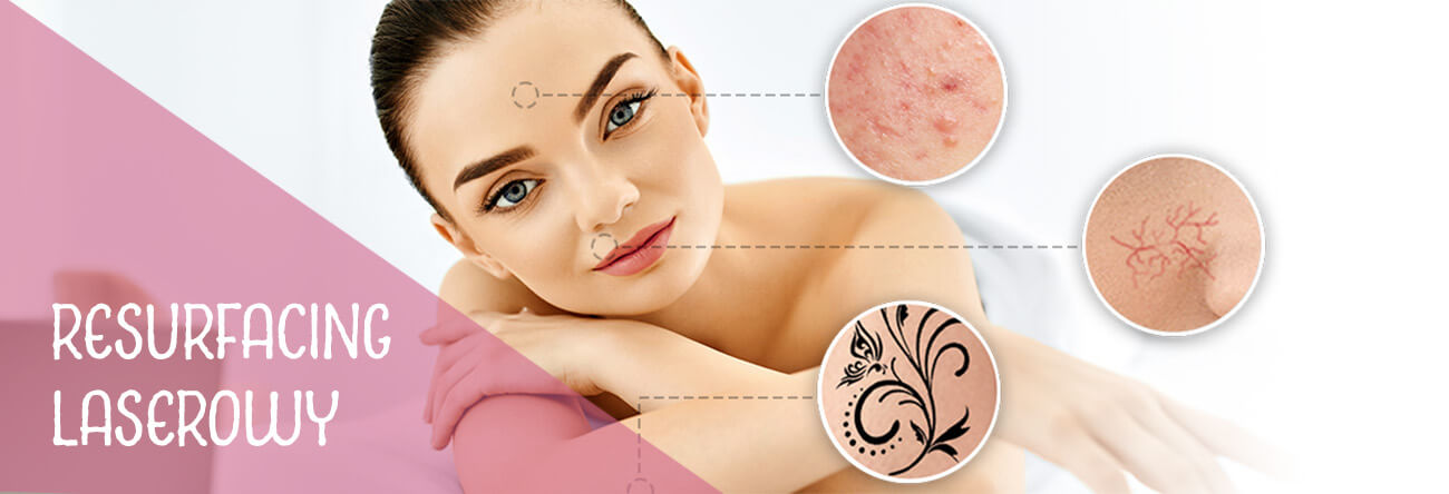 resurfacing laserowy kraków